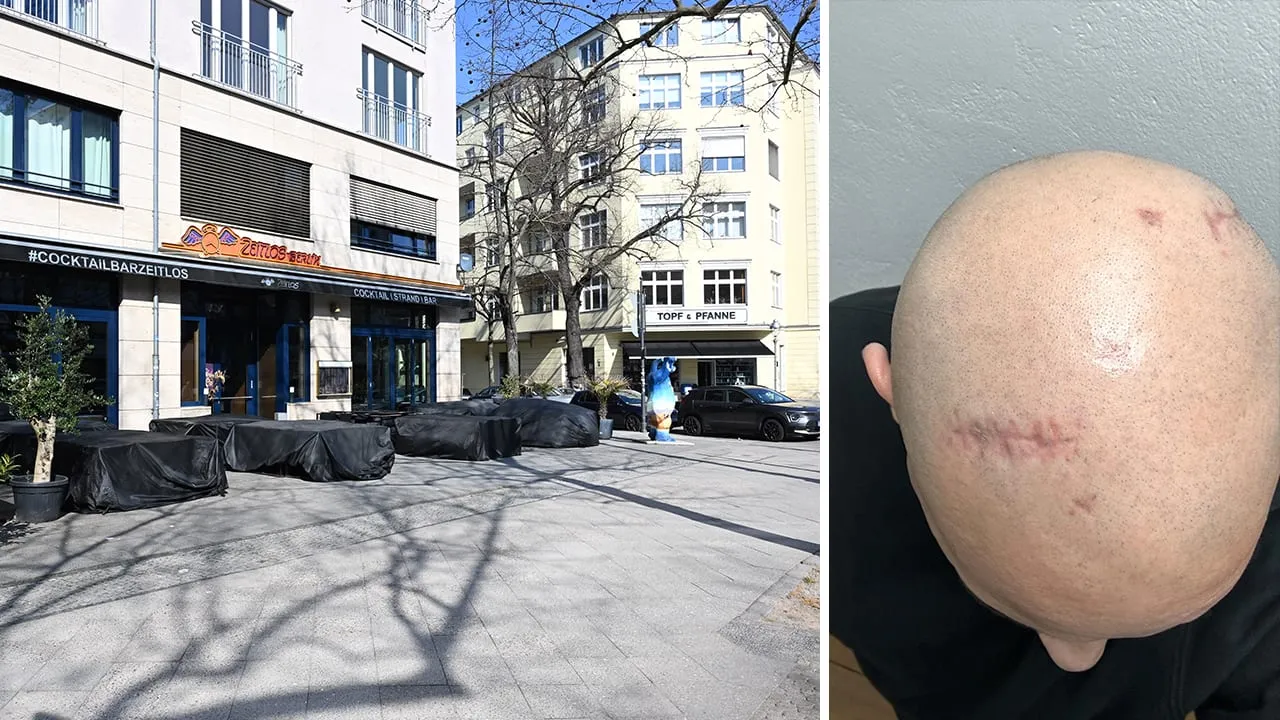 Täter noch nicht gefasst - Hirnblutung nach Prügel-Attacke vor Berliner Bar